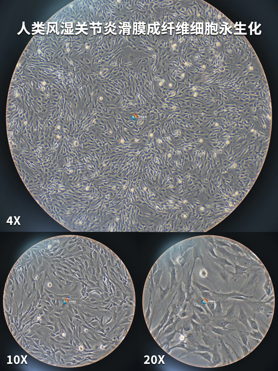 人类风湿关节炎滑膜成纤维细胞永生化，漂亮