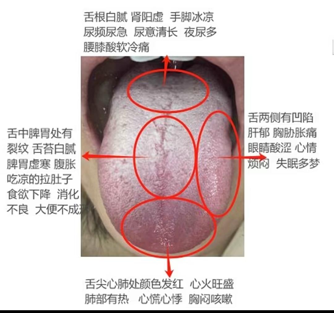 仅供参考日常养生小常识 养生之道 老祖宗的智慧 舌苔辨证 传扬中华文化