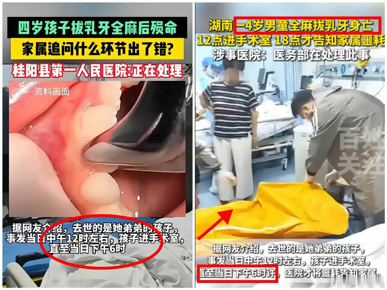 四岁男童拔乳牙身亡疑问重重首先家长有问题，4岁娃干嘛拔掉乳牙？其次，医生的问题更