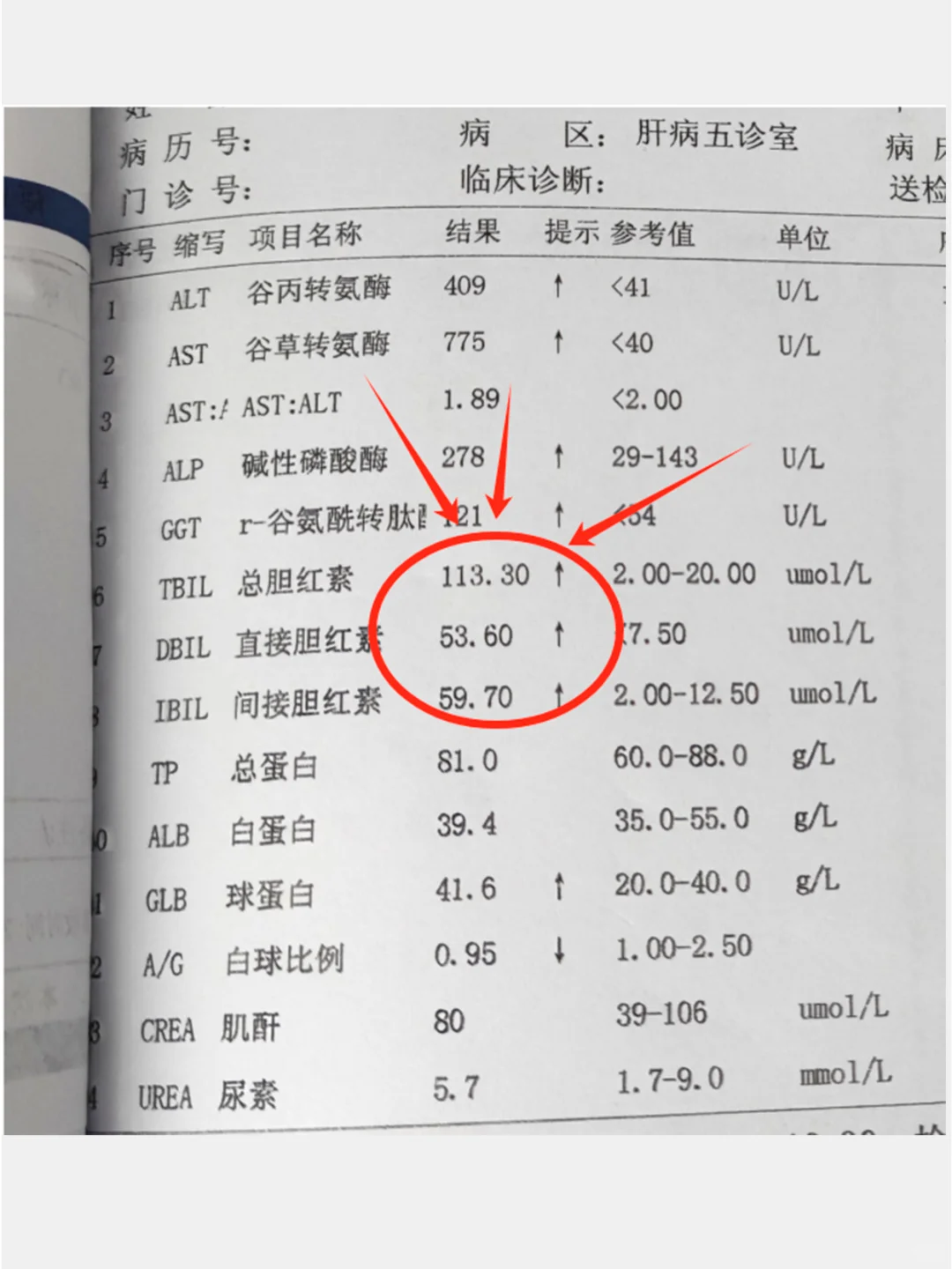 记住→胆红素2个后果，第2个很要命！