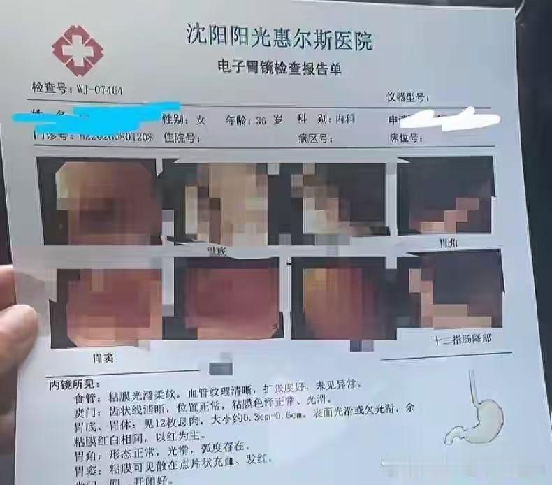 “蹊跷事！”辽宁沈阳，一女子陪丈夫体检，她也顺便做了胃镜。检查时，医生先后改口，