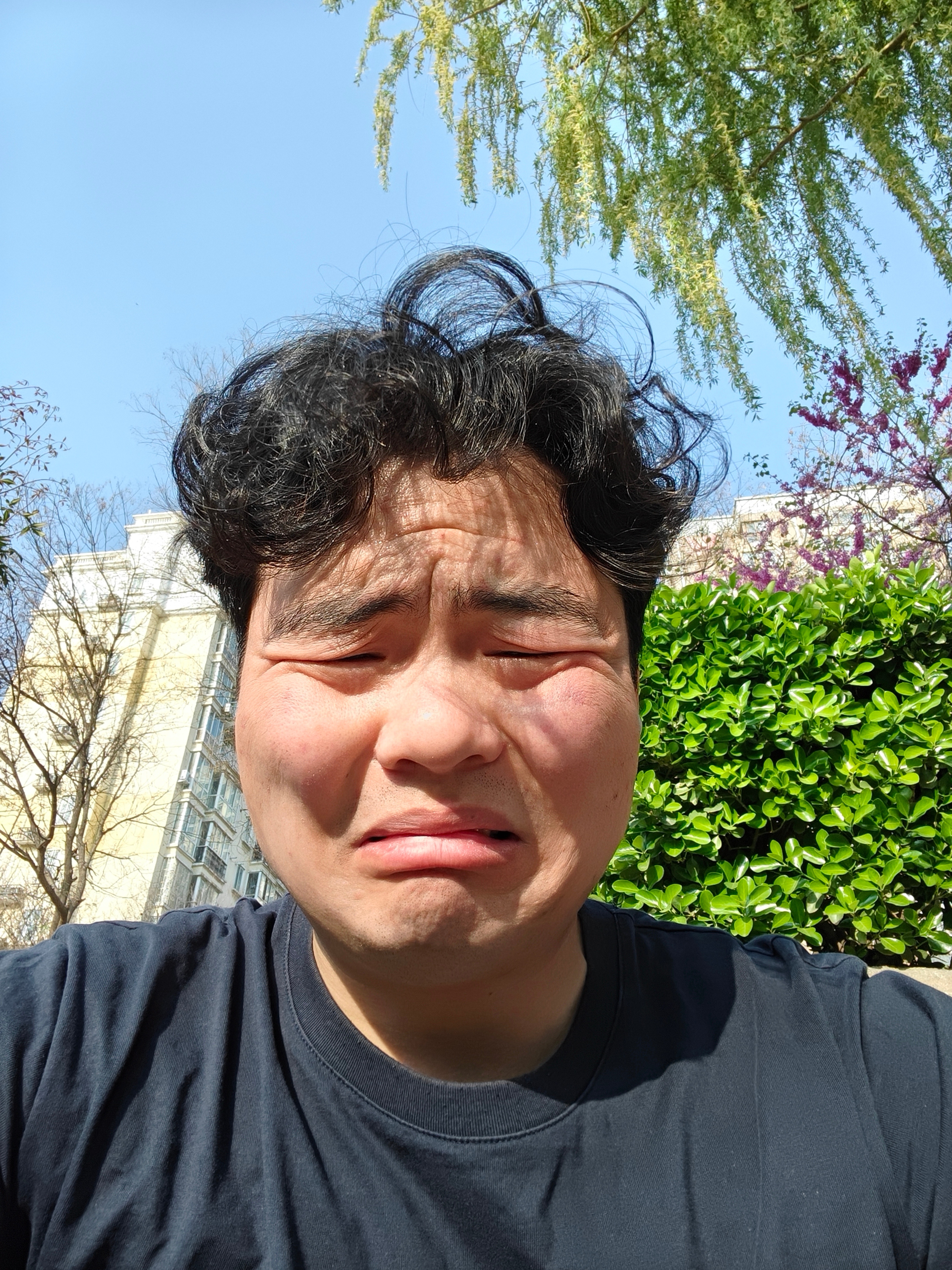 出门晒太阳，反正已经很丑了，晒黑点也不影响什么，好歹能补充点维生素D