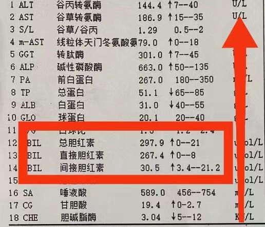 胆红素升高怎么办？需不需要治疗？临床上导致胆红素升高的情况很多。
首先是胆红素轻