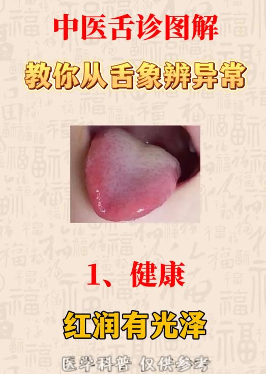 中医舌诊图解：从舌象看身体异常