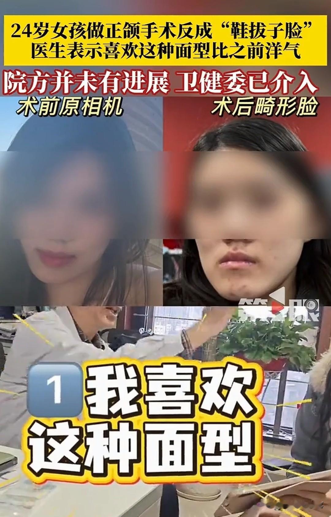 太离谱了！一个补牙的建议，最后变成了正颌手术，术后姑娘的脸直接歪了。术前方案写的
