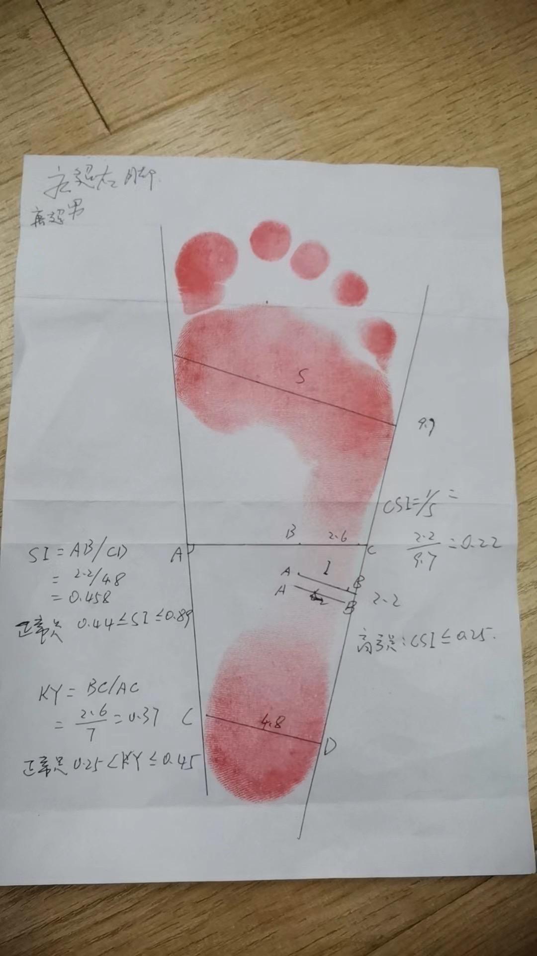 脚影响臀型，你是什么脚型？大家不用再听别人说你是“扁平足”还是“高弓足”了！其实，很多医学专家已经研究了如何评估脚型，用的是CSI指数等方法，很容易就能知道自己的脚型。这些内容在《教你臀出美丽》一书中有详细介绍。臀部训练