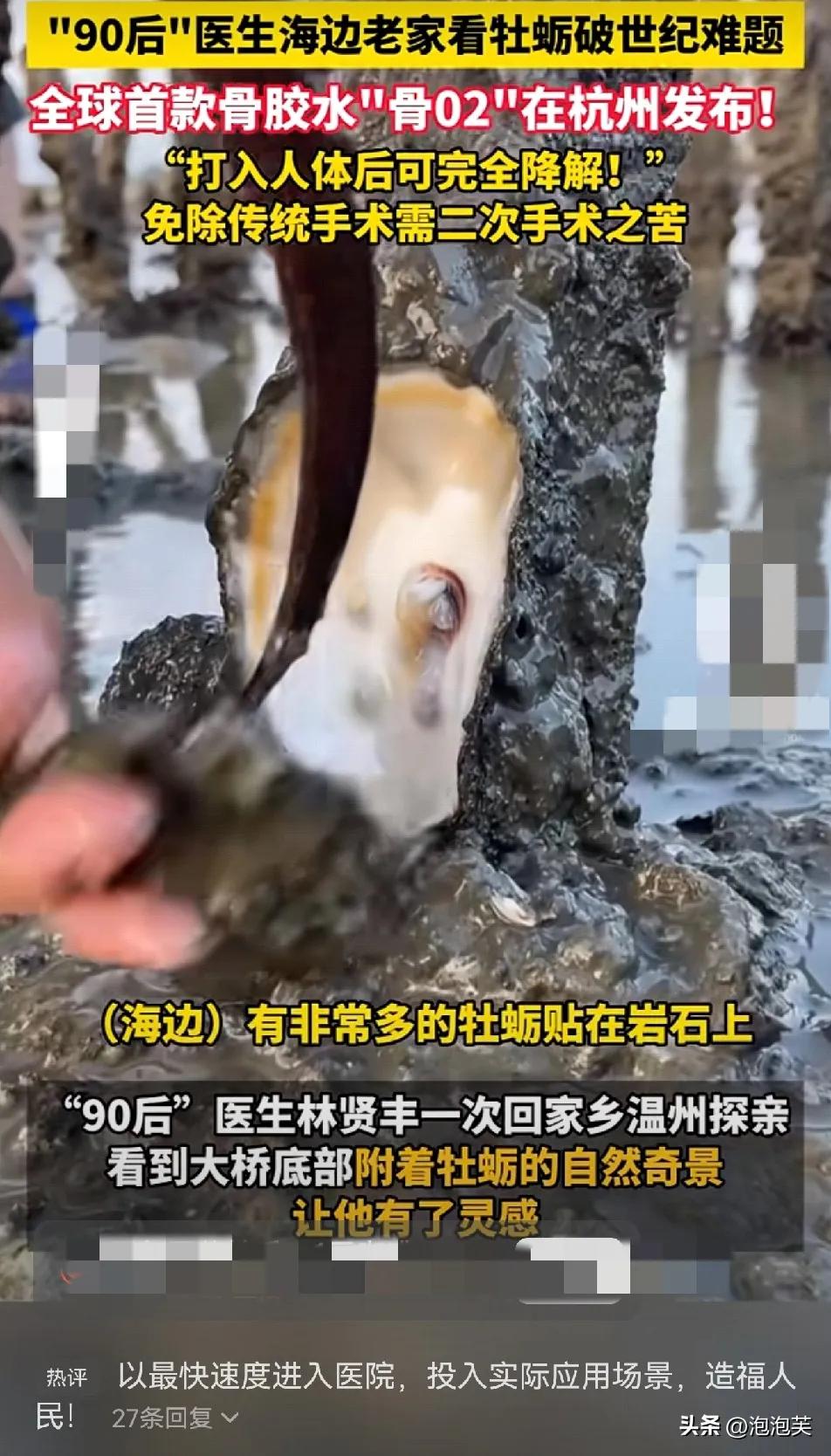 太牛了！90后骨科医生林贤丰，看海边牡蛎粘岩石不掉，竟搞出全球首款能完全降解的“