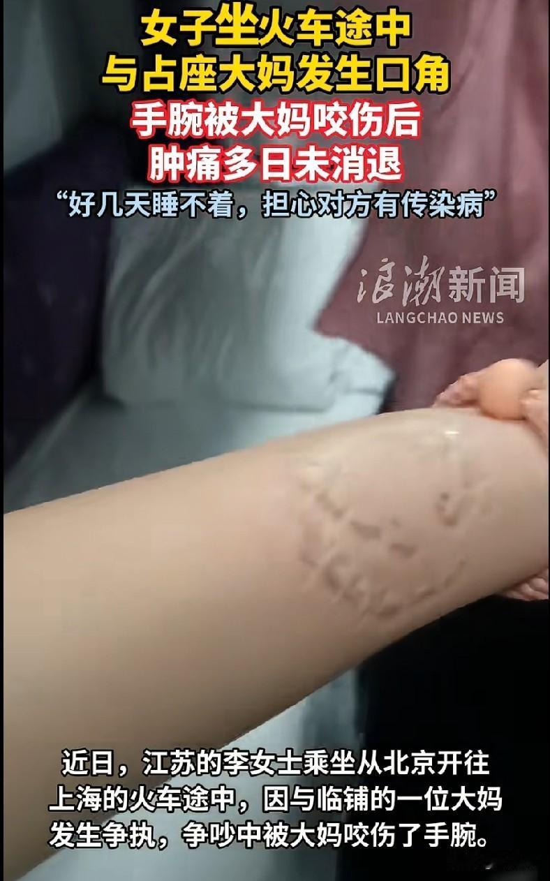 真是大千世界，无奇不有。谁能料到，坐个火车竟会被人咬伤！
近日，江苏的李女士在乘