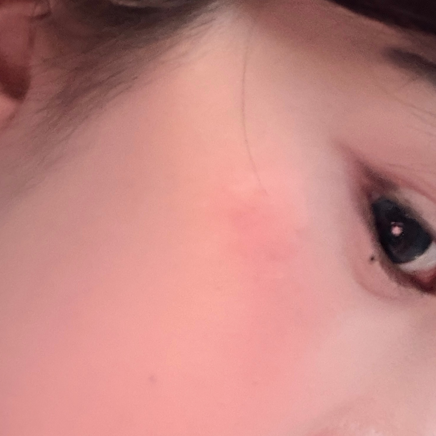 杭州蚊子你何意味在我脸上叮个大包 