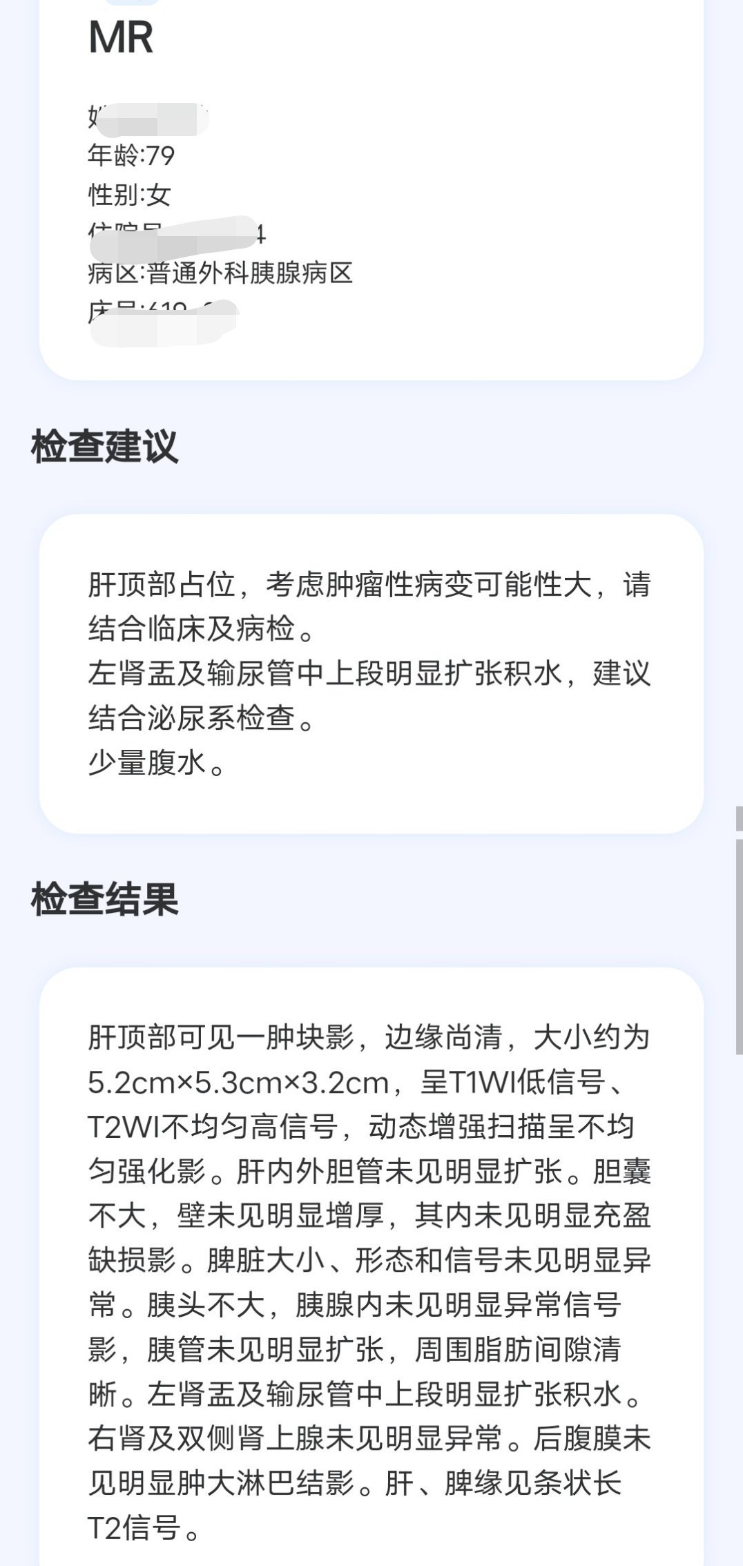 79岁的外婆确诊为肝癌？这种情况严重吗？ ​​​