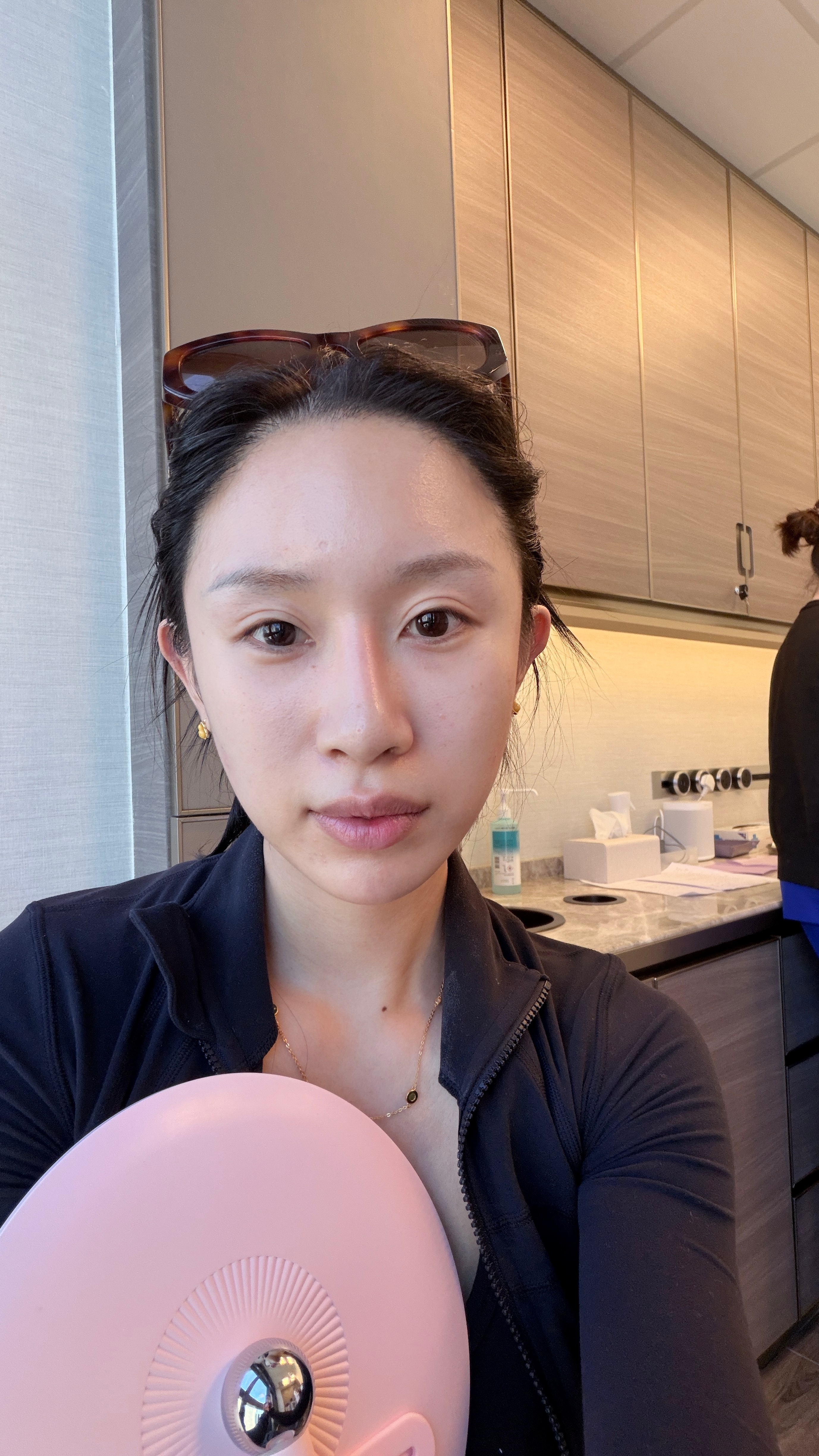 报告！！！又打了两针 昨天同款材料。打在脸颊上。看起来人变善良了图1打之前 图2