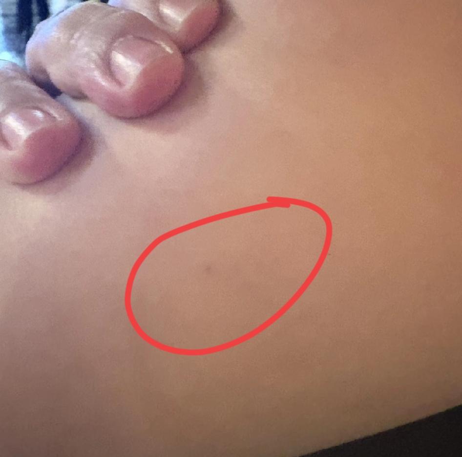 网友发帖称她朋友在伦敦华人街逛街时被人扎针，一穿红外套的老妇人得手后举着针筒跑了