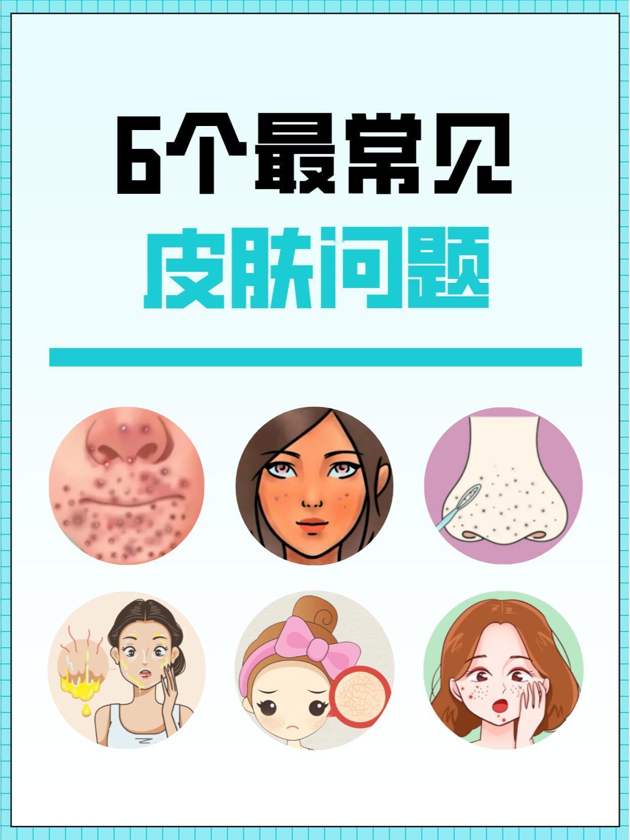 是不是常对着镜子，为皮肤问题愁眉不脸？别愁啦，6大常见皮肤问题及改善方法大公开！