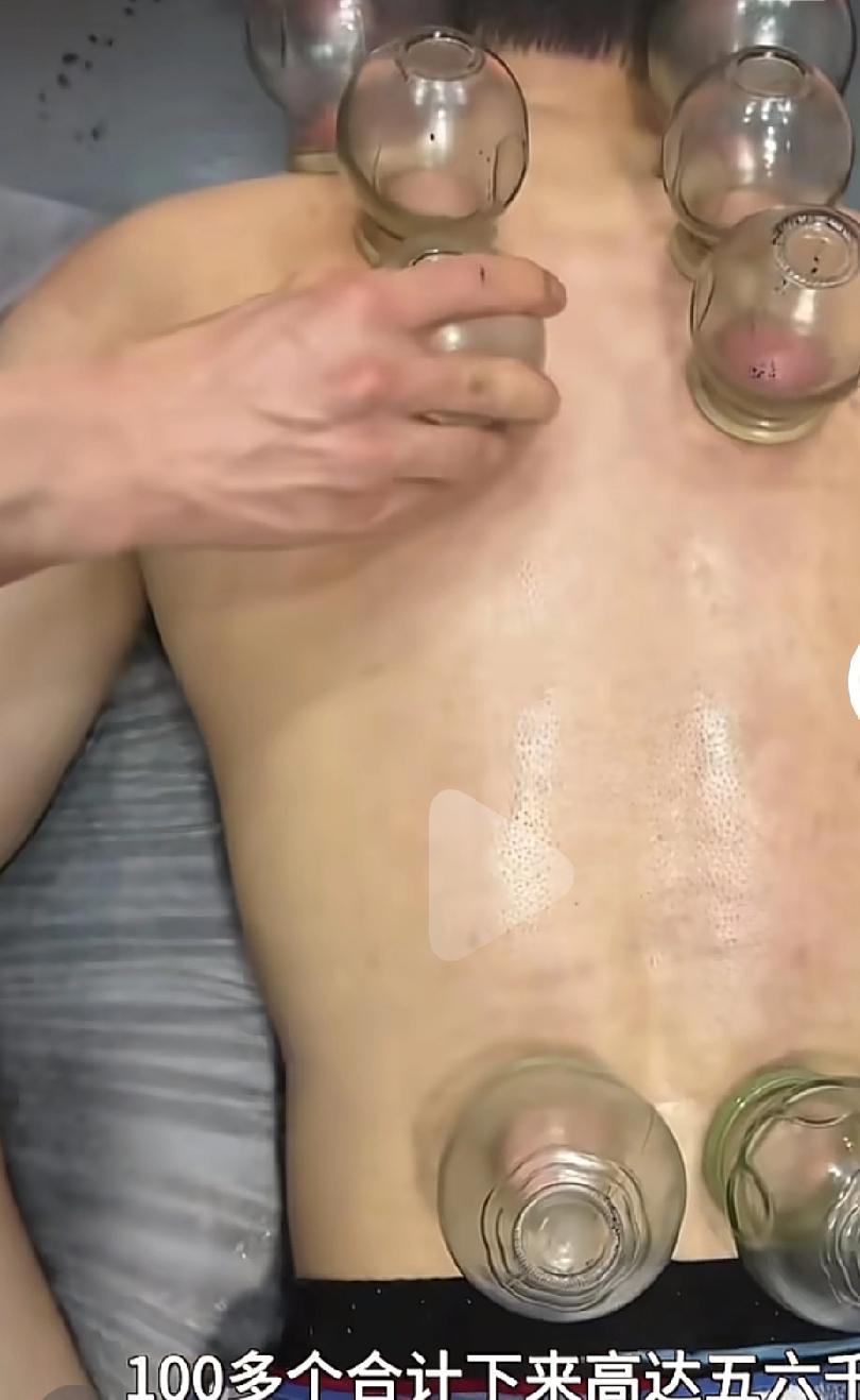 江苏一理发店推出美女拔罐，很多人慕名而来，结果拔罐师傅完全不讲武德，上来就往顾客