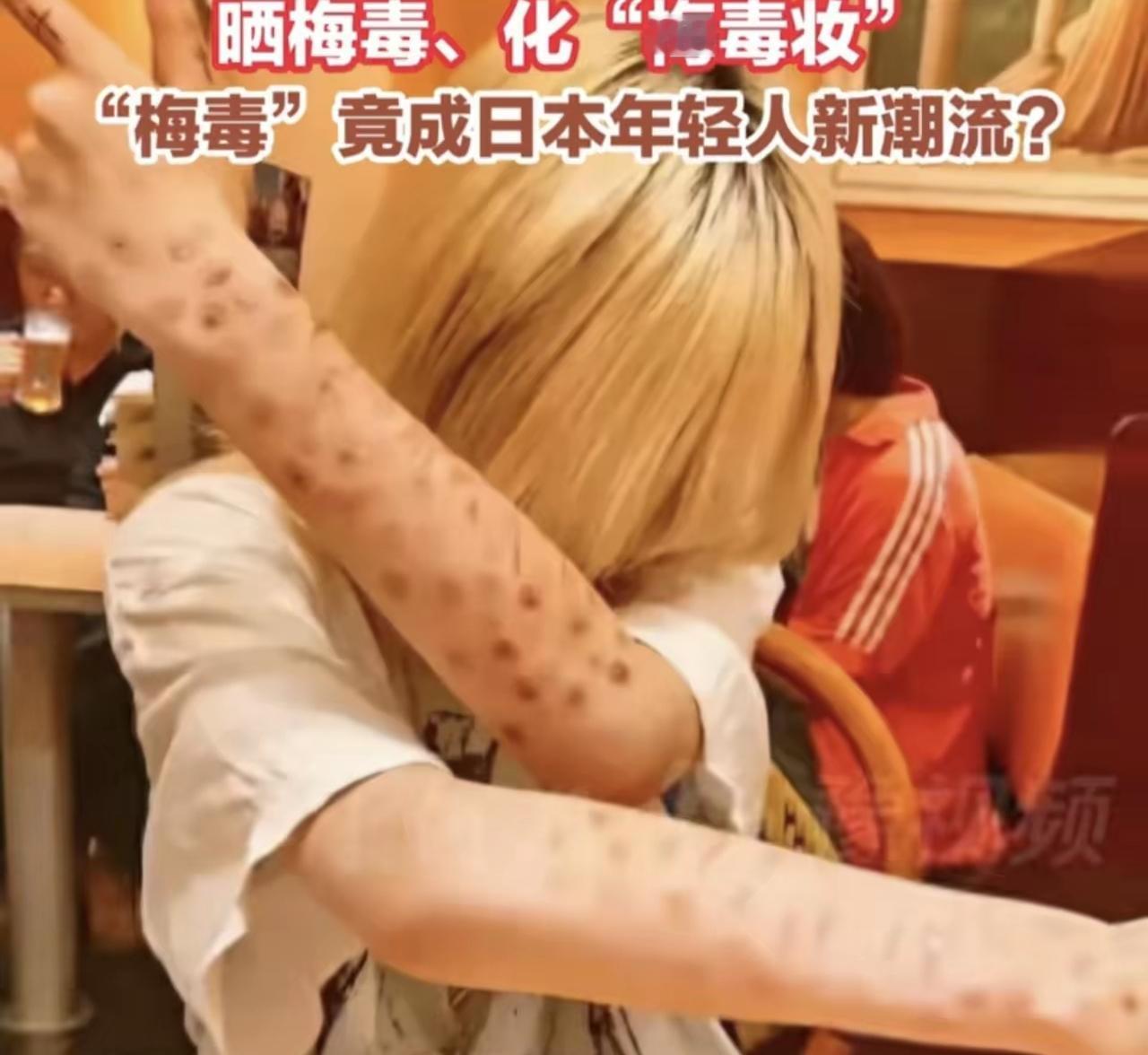 梅毒，竟成为了日本年轻人的时尚:晒梅毒、化梅毒妆。这个国家，病得不轻——不仅仅是