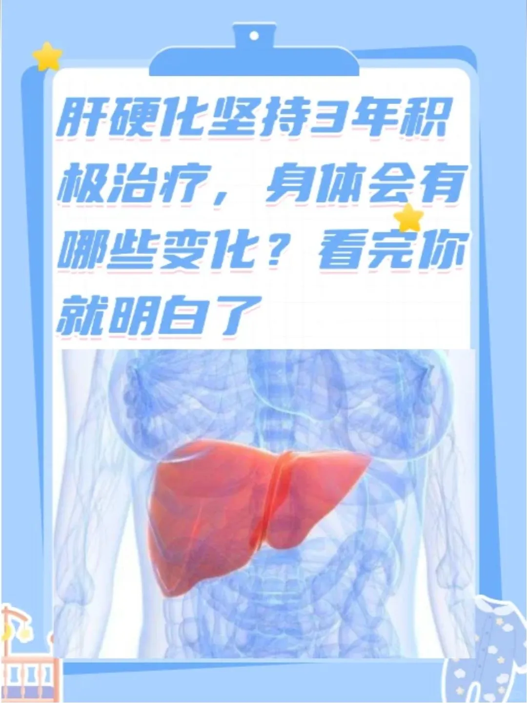 肝硬化坚持3年积极治疗，身体会有哪些变化