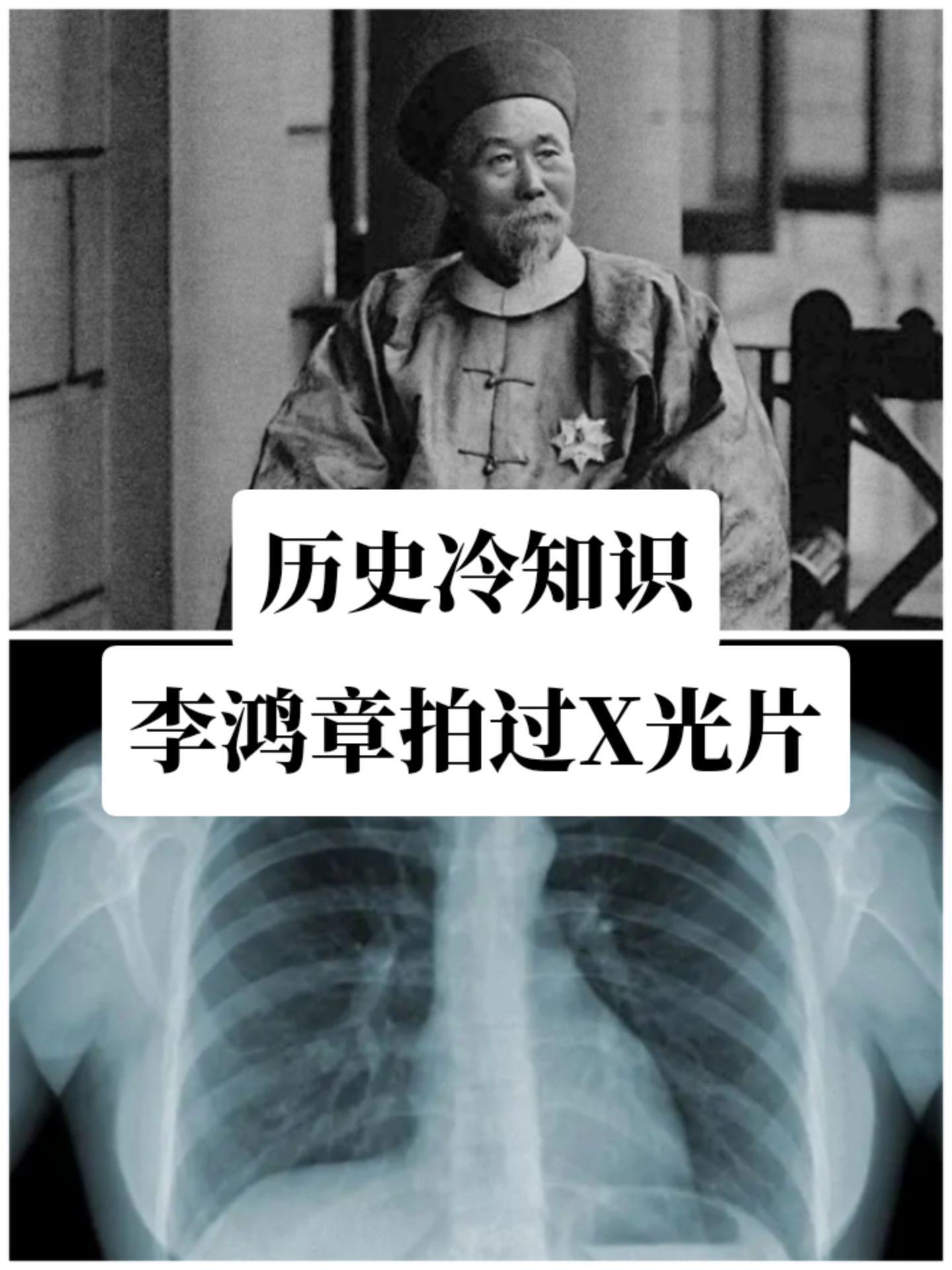 医学奇迹清朝