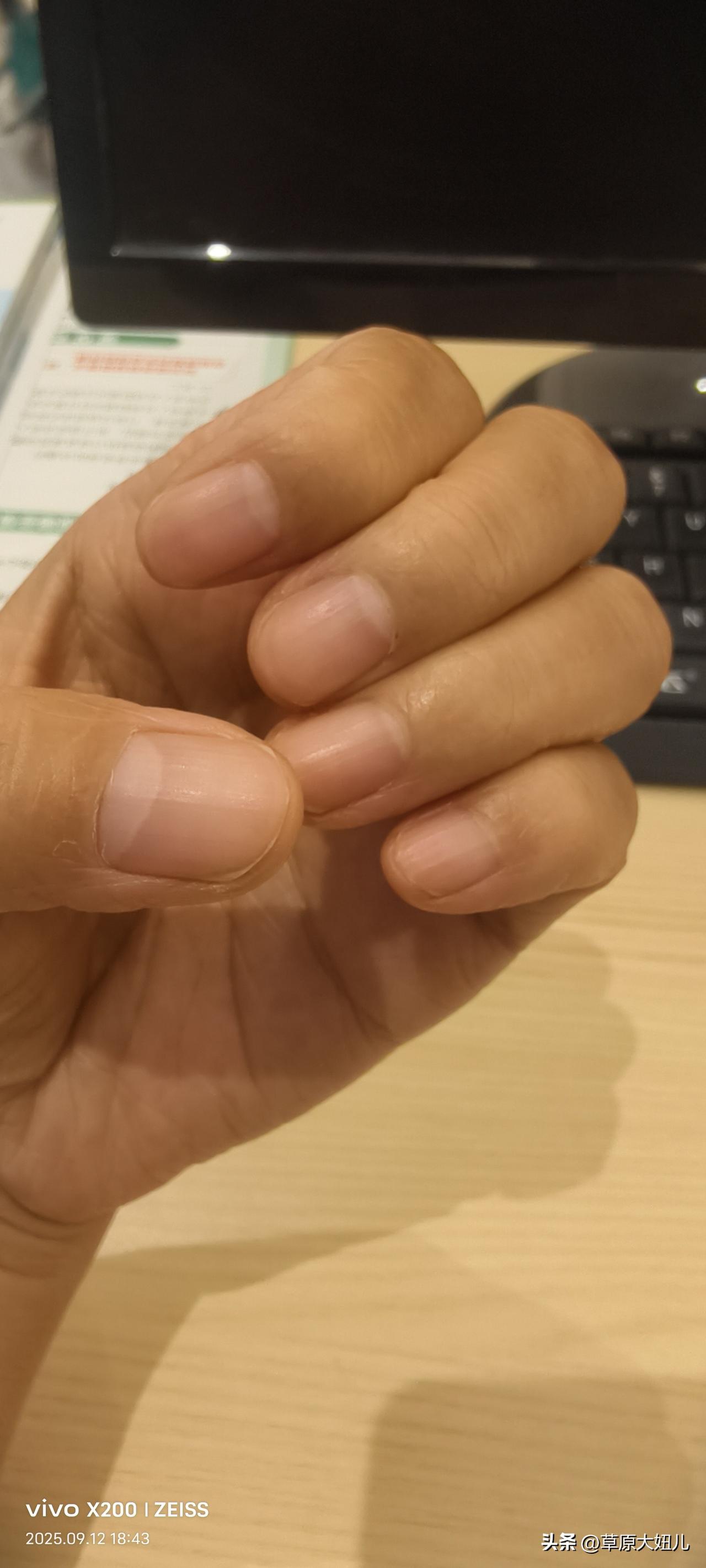 中医说我脾虚，肾虚，气血虚，湿气重
胃火大肝火大肺火大
这样阳虚那心虚
每次一号