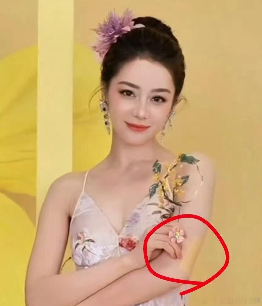 迪丽热巴胳膊上贴了膏药迪丽热巴胳膊上贴了膏药！迪丽热巴手臂上贴了膏药 ​​​
