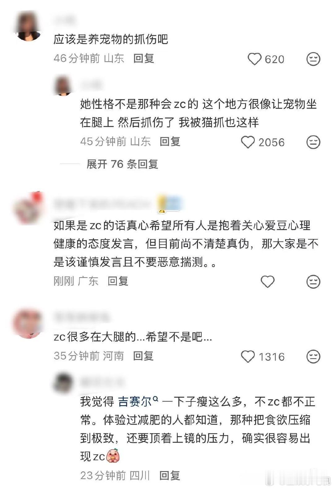 吉赛尔的腿咋了 吉赛尔最新舞台直拍 大腿上好多抓痕啊 咋回事？！吉赛尔大腿抓痕