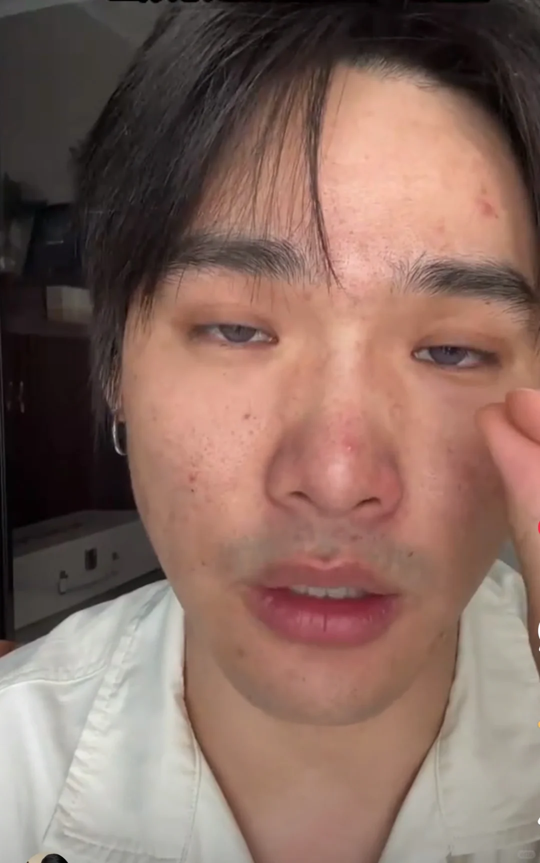 p1无意翻到23年的皮肤状态 真的好差啊！那时候感觉压力好大身心疲惫！...