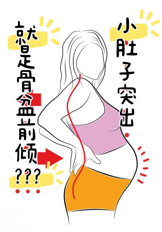 小肚子突出就是骨盆前倾？？？