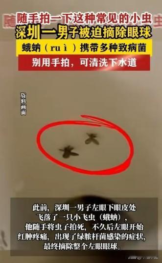 好可怕！广东深圳，一男子在卫生间上厕所时，偶然拍死了一只飞落在眼睑上的蛾蚋，起初