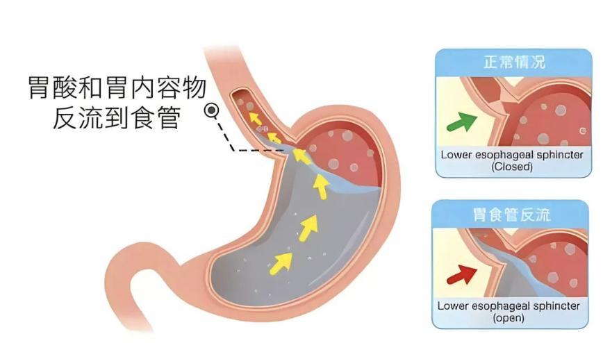最近在门诊家长总会问我:“我的孩子是不是积食了？”“该给孩子吃多少，就怕Ta会积