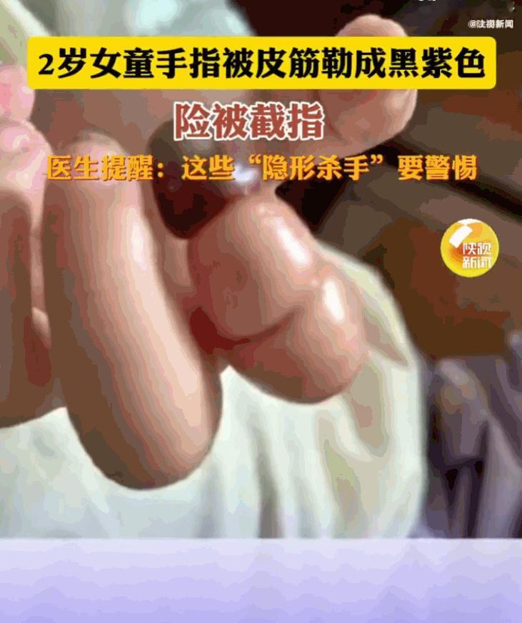 太危险了！一名年仅2岁的女童，就因为一根小小的橡皮筋，午睡醒来后，一根手指竟面临