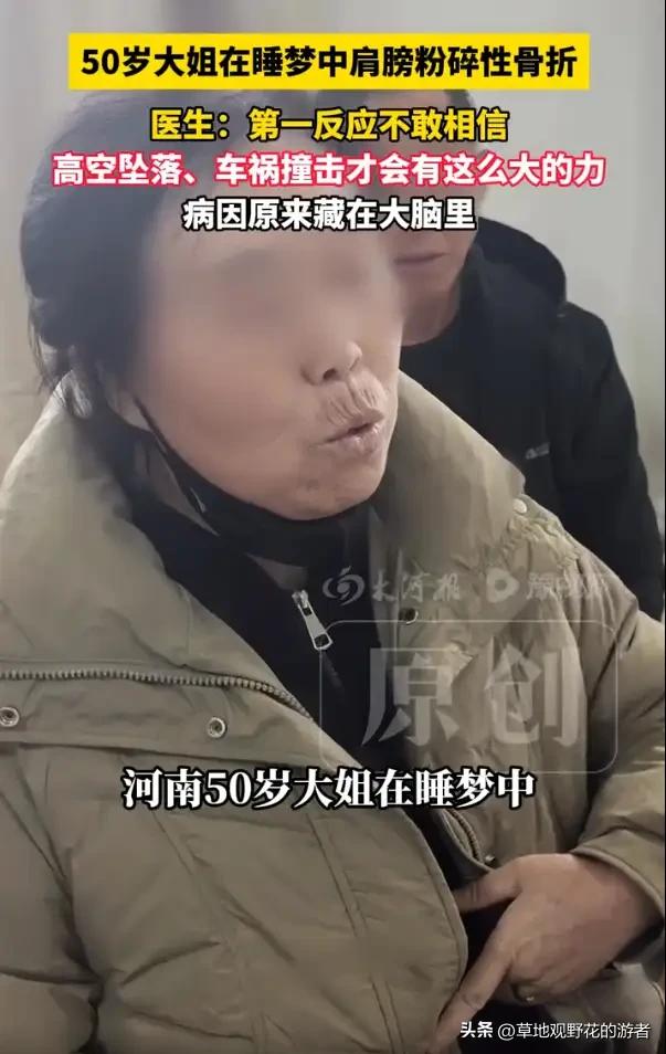 这下解释不清了！河南，一位50岁大姐肩膀粉碎性骨折，来到医院后，医生还以为是被车