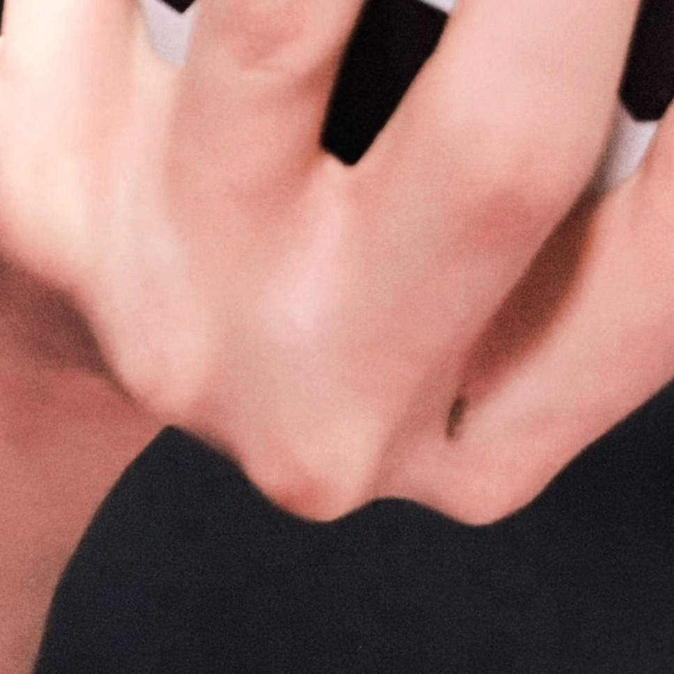 伤口结痂了 可我们至今都不知道是为什么受伤