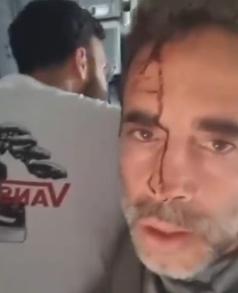 30秒急坠14000英尺：迪拜航空副机长持刀刺机长，被视为恐袭！驾驶舱门到底该防