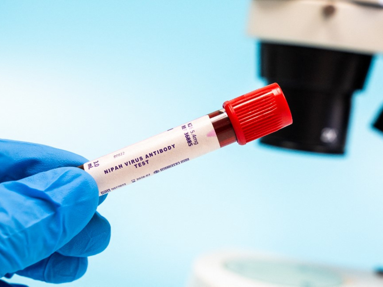 世卫组织近日通报，印度西孟加拉邦近期确诊两例尼帕病毒病例，患者均为医护人员。这是