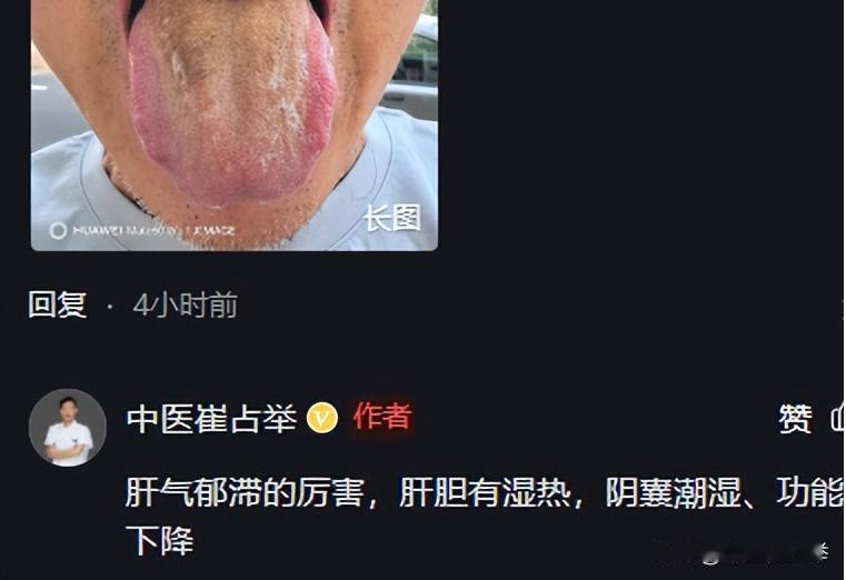 一直坚持在帮大家看舌象
只要你留，我必回复
拍摄注意：
自然光线
舌头拍全
不要