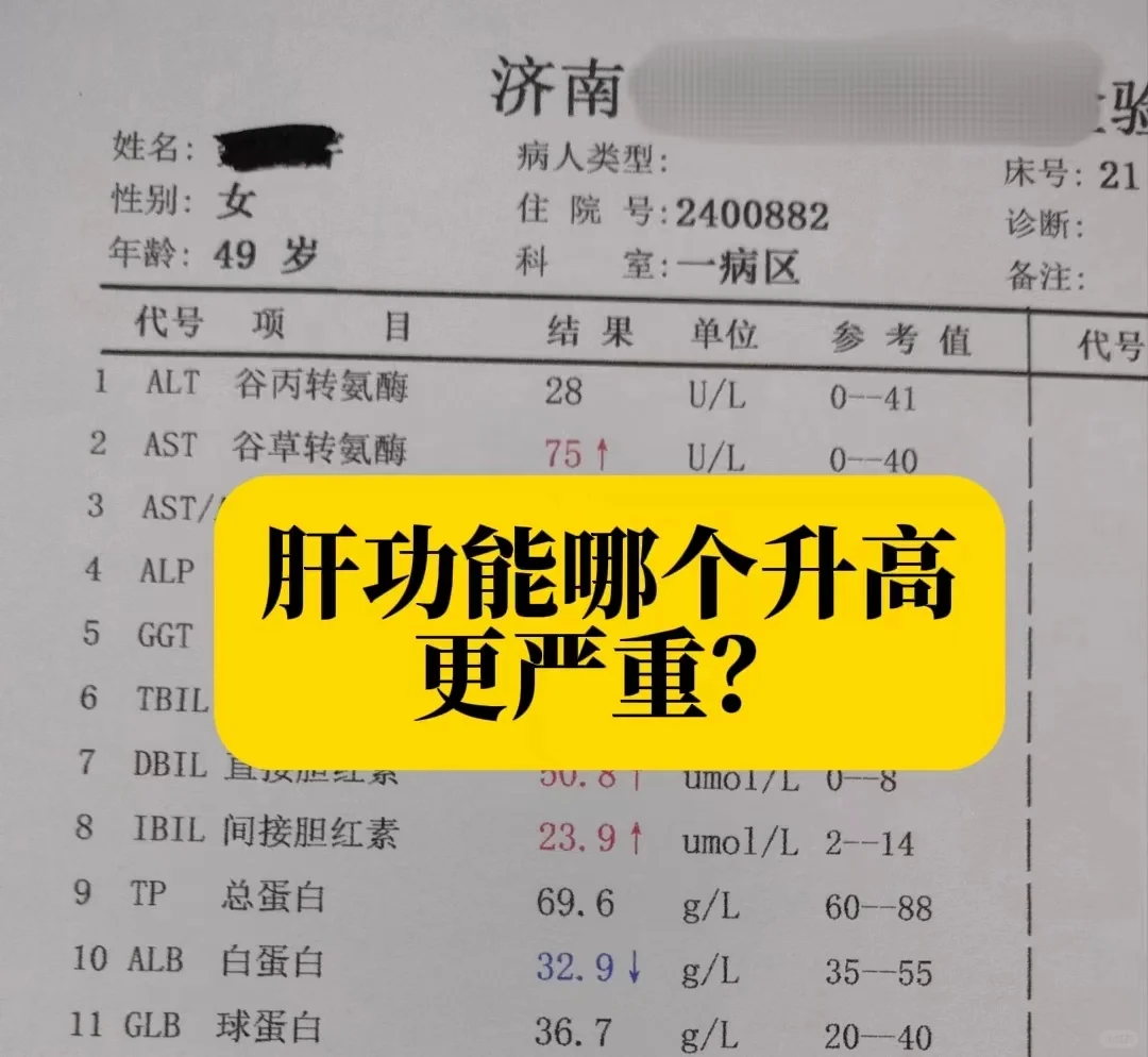 肝功能哪个升高更严重？