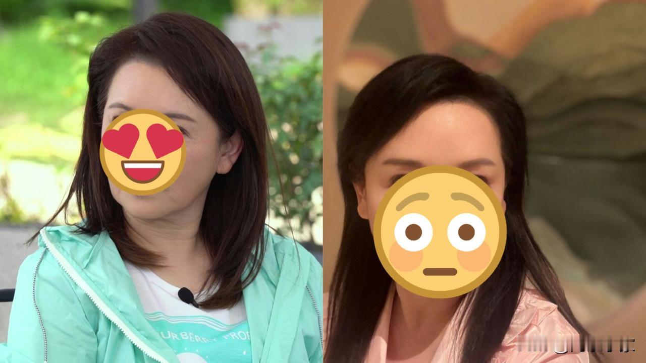 60岁TVB前当家花旦大晒「术後照」　块面变细下巴极尖极满意成果
现年60岁昔日