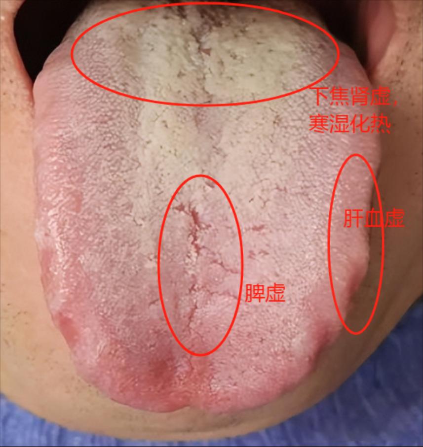 辛苦一年回到家，面对老婆却“软不拉几”的，还没动几下就了了结束，吃了补肾药却没有