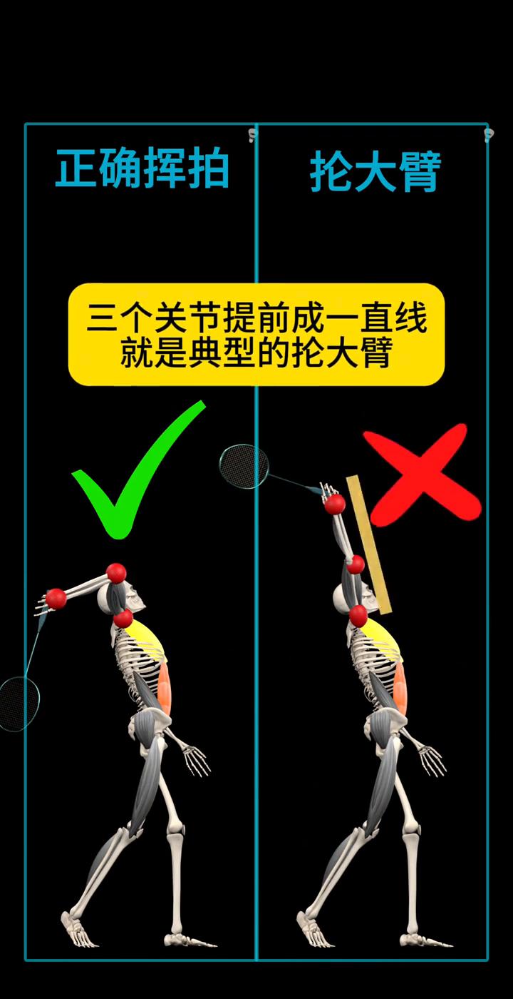 正确挥拍抢大臂。
怎么判断是否抢大臂？三个关节提前成一直线就是典型的抢大臂。