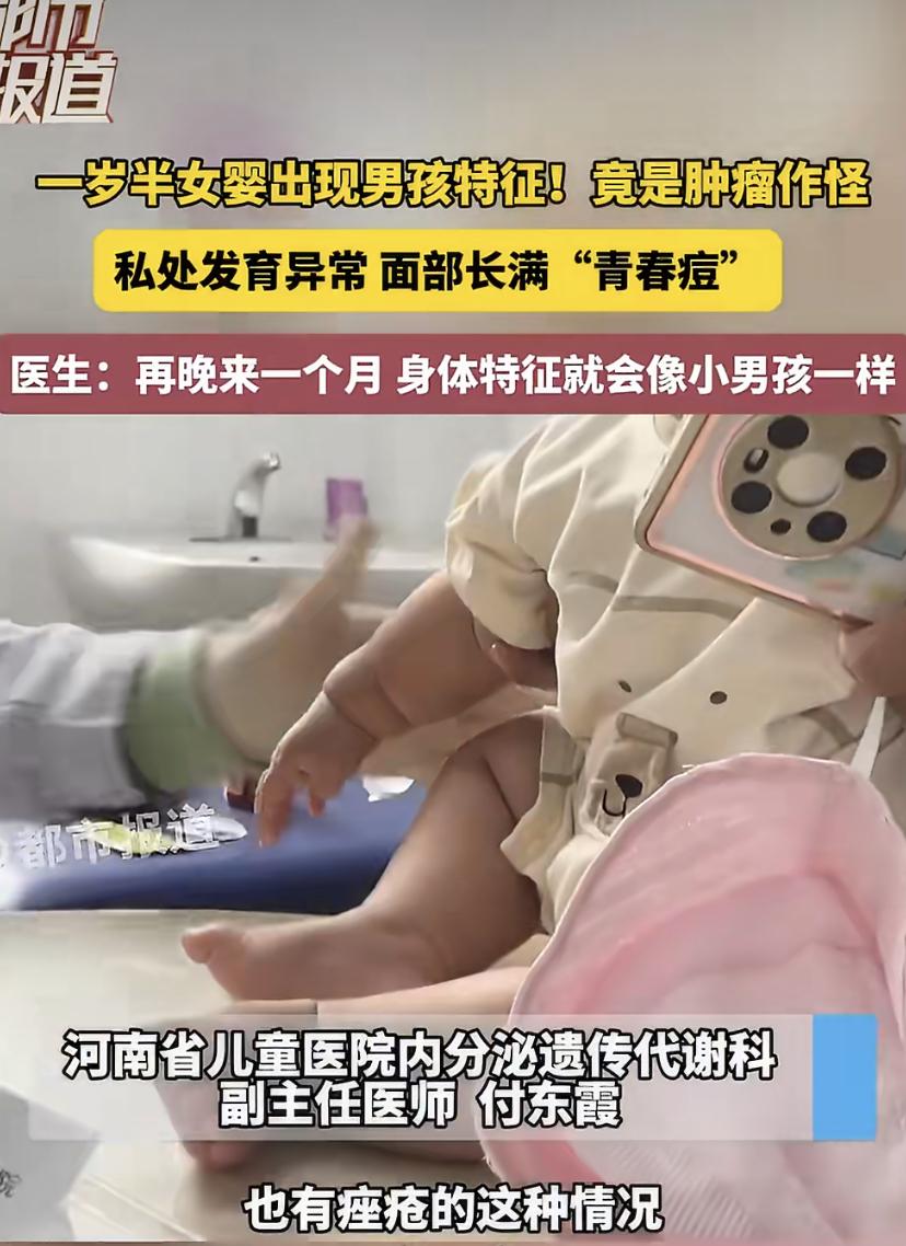 河南一个1岁半的女宝，不到一个月突然变了样：脸上长满青春痘，私处也出现异常，阴蒂