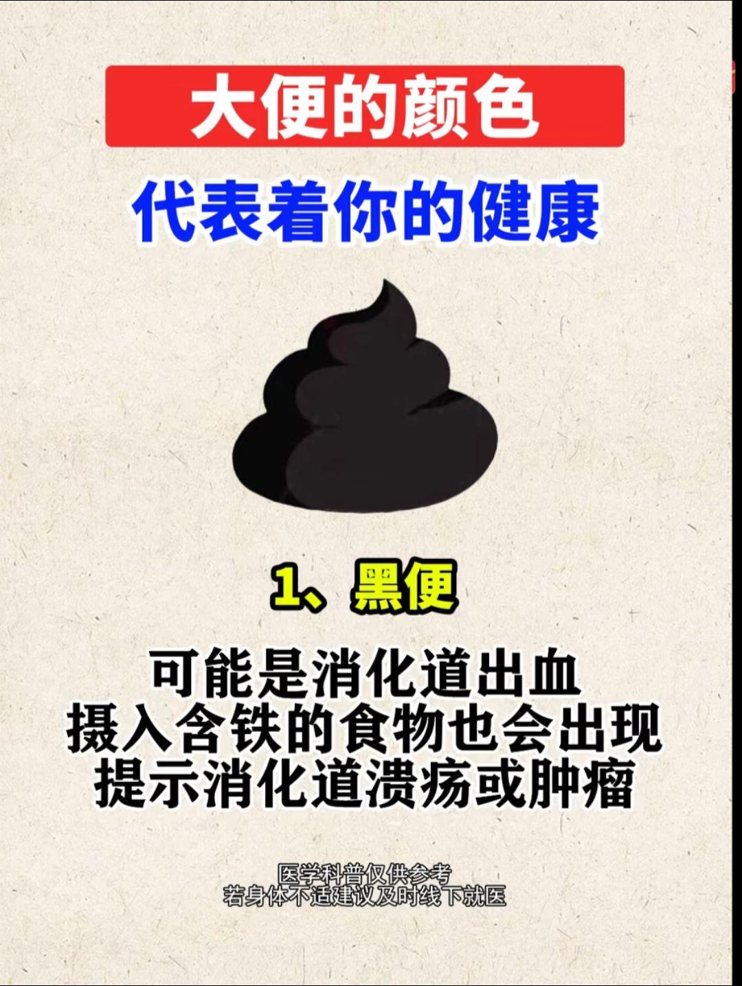 大便的颜色代表的你的健康。