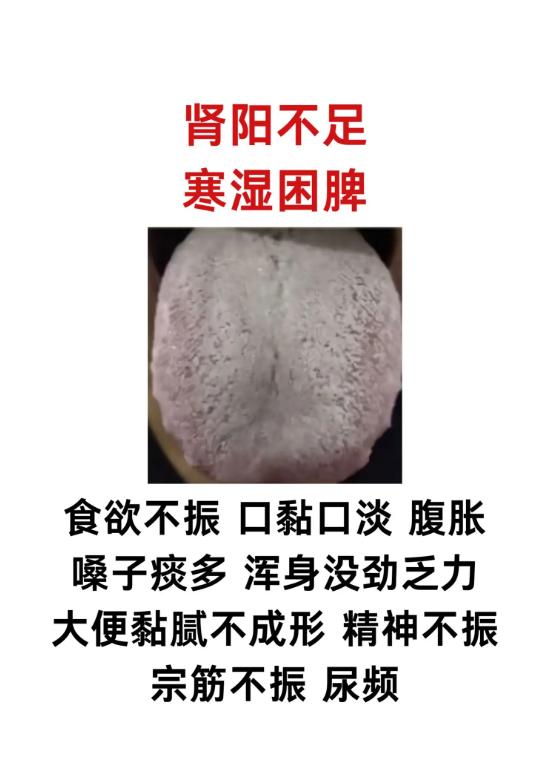 观舌辨证：不同体质对应不同身体信号