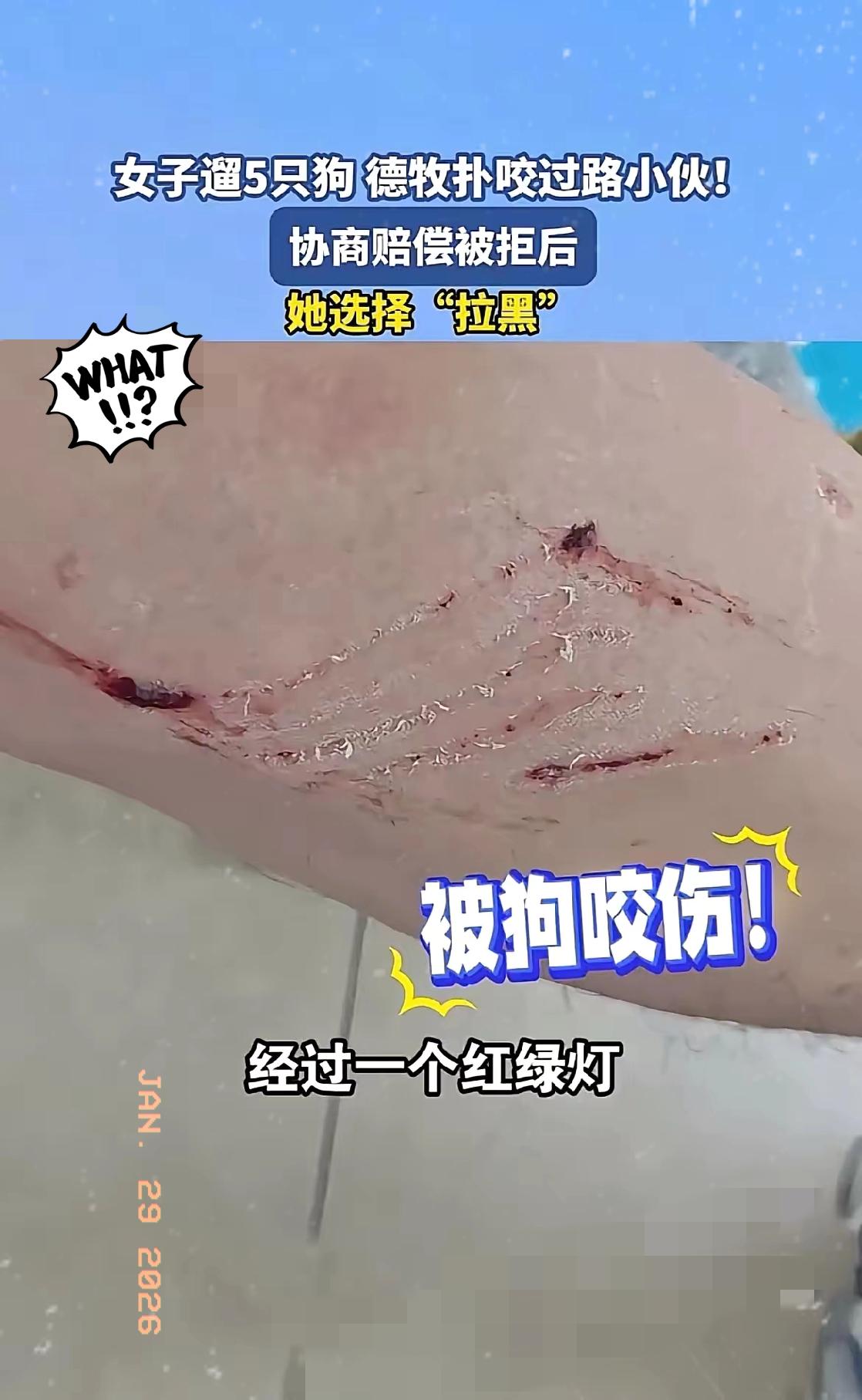 必须严惩！深圳，一女子遛5条狗，在等红绿灯时，其中一只德牧扑咬过路小伙，赔偿协商