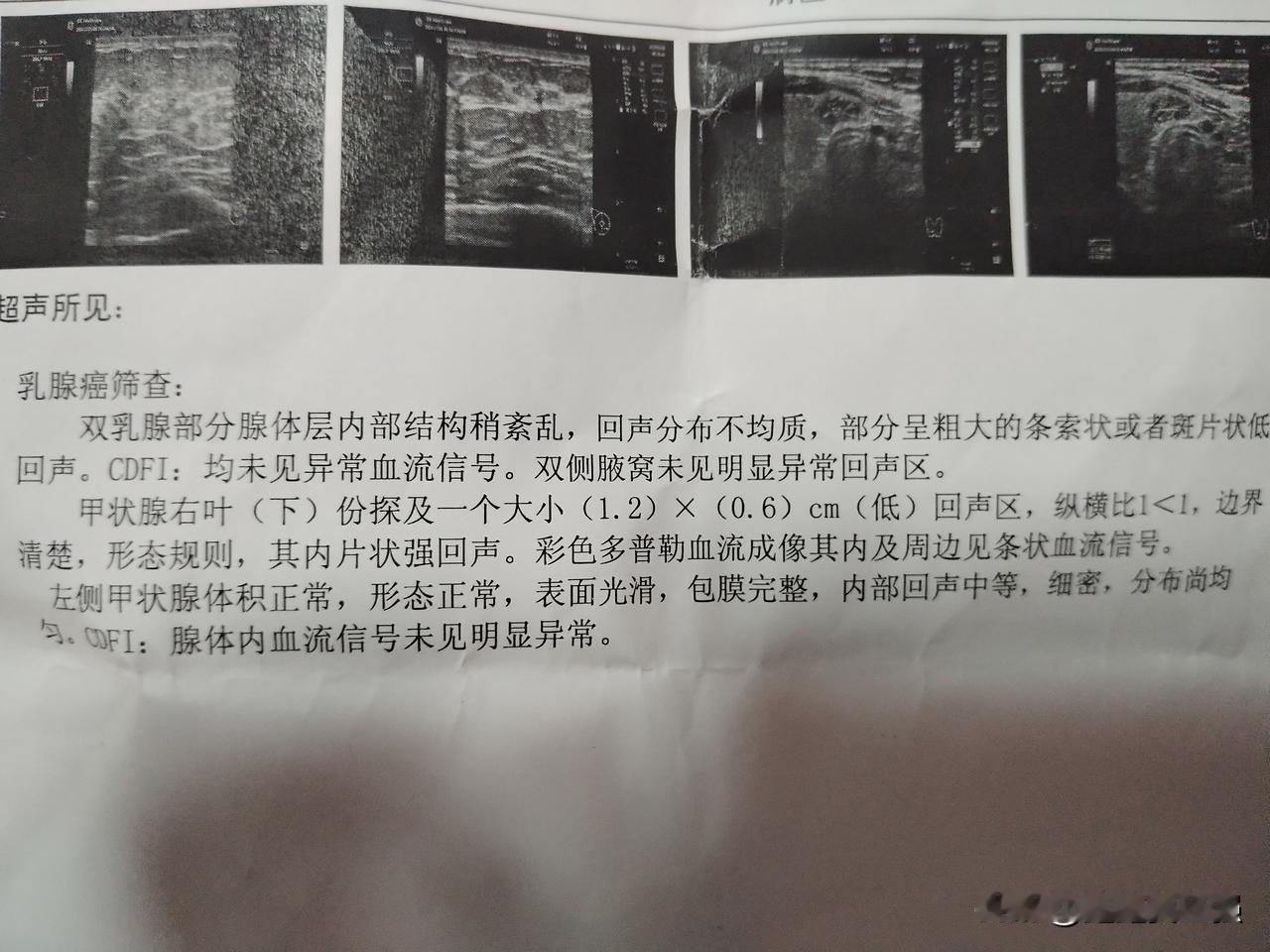 体检查出问题，医生说要注意观察，半年后复查。
姐妹们，你们那边有政府出的免费两癌