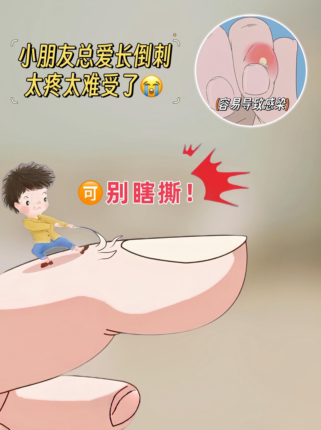 妈妈们~你家孩子手上也起倒刺吗？孩子手指皮薄，起倒刺真的太疼太难受了！可千万不要