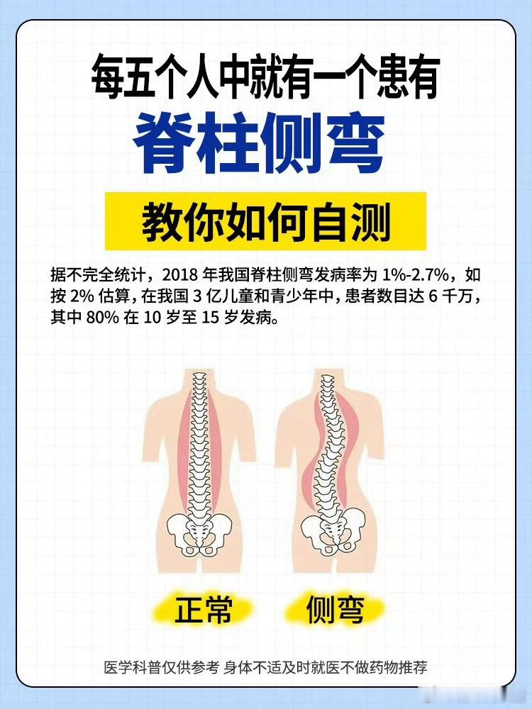 看演唱会发现自己脊柱侧弯了我去 看来看看 