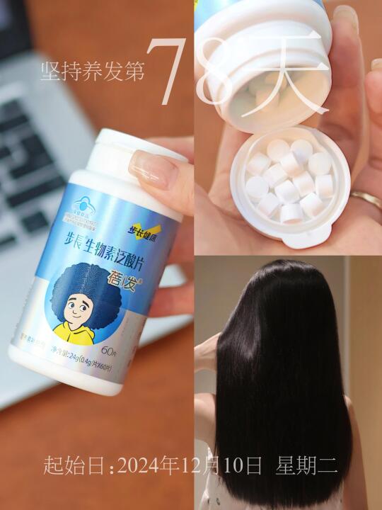 已被驯服！关于脱发这题我可太有发言权了！