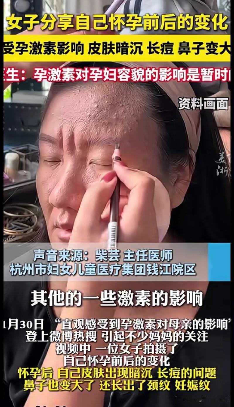 这视频看完真的鼻子一酸——怀孕哪是“变丑”啊，是拿自己的颜值换宝宝的平安啊！
 
