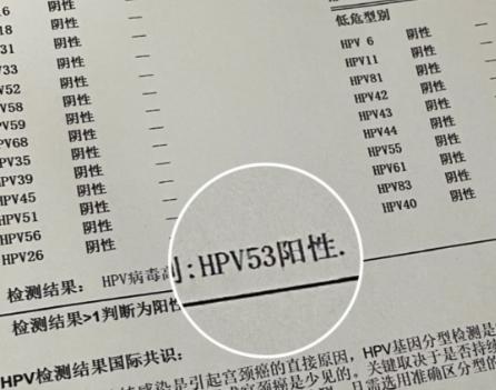 查出HPV阳性就是性生活混乱？错！它的传播途径比你想象的更广
在体检查出HPV阳