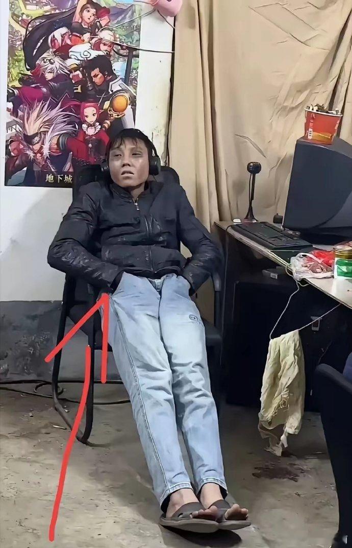 这真的是熬夜熬的吗？太吓人了，这🉐多少天没睡觉了？  