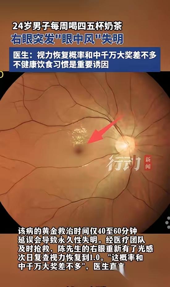 福州24岁小伙太惨了，就因为爱喝奶茶，每周四五杯，结果某天右眼突然看不见，差点失